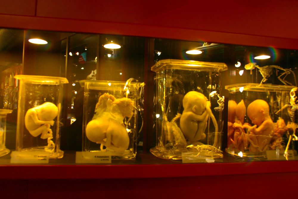 Visit Museum Vrolik in Amsterdam Live the World Visit Museum Vrolik in Amsterdam Live the World